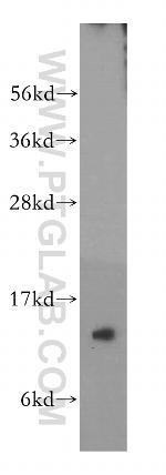 FXN Antibody in Western Blot (WB)