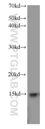 FXN Antibody in Western Blot (WB)