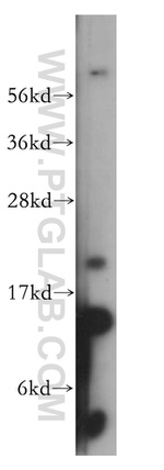 FXN Antibody in Western Blot (WB)