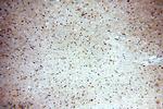 ABT1 Antibody in Immunohistochemistry (Paraffin) (IHC (P))