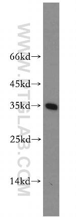 ABT1 Antibody in Western Blot (WB)