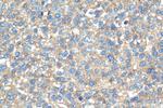 RP2 Antibody in Immunohistochemistry (Paraffin) (IHC (P))