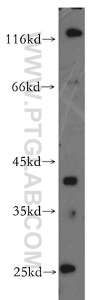 RP2 Antibody in Western Blot (WB)