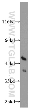 RP2 Antibody in Western Blot (WB)