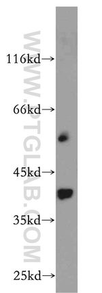 RP2 Antibody in Western Blot (WB)