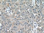 EBF1 Antibody in Immunohistochemistry (Paraffin) (IHC (P))