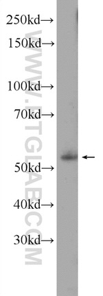 EBF1 Antibody in Western Blot (WB)