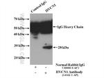 HVCN1 Antibody in Immunoprecipitation (IP)