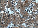 IRF9 Antibody in Immunohistochemistry (Paraffin) (IHC (P))