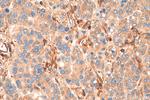 Talin-1 Antibody in Immunohistochemistry (Paraffin) (IHC (P))