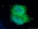 Talin-1 Antibody in Immunocytochemistry (ICC/IF)