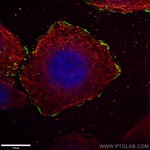 Talin-1 Antibody in Immunocytochemistry (ICC/IF)