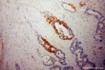 Talin-1 Antibody in Immunohistochemistry (Paraffin) (IHC (P))