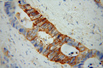 Talin-1 Antibody in Immunohistochemistry (Paraffin) (IHC (P))