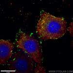 Talin-1 Antibody in Immunocytochemistry (ICC/IF)