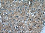 Talin-1 Antibody in Immunohistochemistry (Paraffin) (IHC (P))