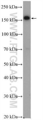 UGCGL1 Antibody in Western Blot (WB)