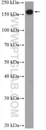 UGCGL1 Antibody in Western Blot (WB)