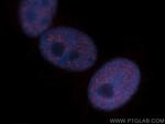 CHD4 Antibody in Immunocytochemistry (ICC/IF)