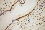 CHD4 Antibody in Immunohistochemistry (Paraffin) (IHC (P))