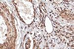 CHD4 Antibody in Immunohistochemistry (Paraffin) (IHC (P))