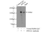 Liprin alpha 1 Antibody in Immunoprecipitation (IP)