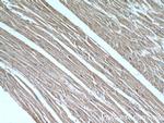 B3GALT2 Antibody in Immunohistochemistry (Paraffin) (IHC (P))