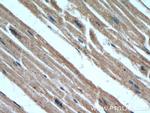 B3GALT2 Antibody in Immunohistochemistry (Paraffin) (IHC (P))