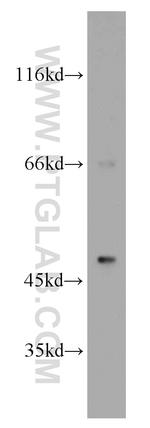 B3GALT2 Antibody in Western Blot (WB)