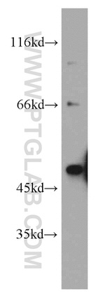 B3GALT2 Antibody in Western Blot (WB)