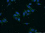 alpha-1B-glycoprotein Antibody in Immunocytochemistry (ICC/IF)