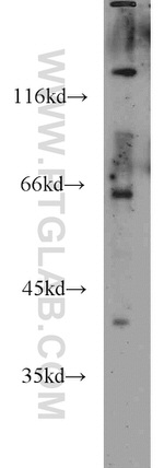 alpha-1B-glycoprotein Antibody in Western Blot (WB)