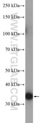 UPP1 Antibody in Western Blot (WB)