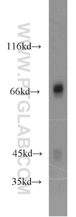 PKC delta Antibody in Western Blot (WB)