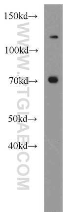 CAT-1 Antibody in Western Blot (WB)