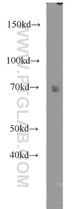 CAT-1 Antibody in Western Blot (WB)