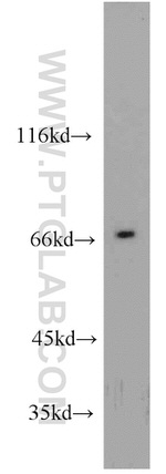 CAT-1 Antibody in Western Blot (WB)