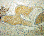 CAT-1 Antibody in Immunohistochemistry (Paraffin) (IHC (P))