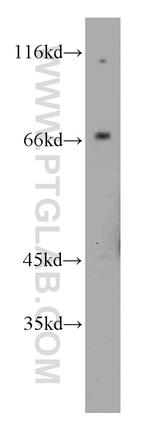 CAT-1 Antibody in Western Blot (WB)