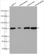 SLC27A6 Antibody in Western Blot (WB)