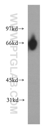 GFI1 Antibody in Western Blot (WB)