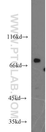 TNK1 Antibody in Western Blot (WB)