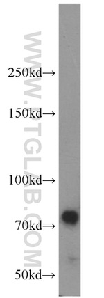 TNK1 Antibody in Western Blot (WB)