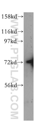 TNK1 Antibody in Western Blot (WB)