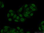 CSTF2T Antibody in Immunocytochemistry (ICC/IF)