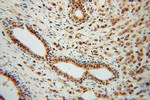 CSTF2T Antibody in Immunohistochemistry (Paraffin) (IHC (P))