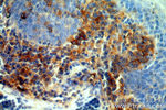 CD39/ENTPD1 Antibody in Immunohistochemistry (Paraffin) (IHC (P))