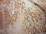 KChIP1 Antibody in Immunohistochemistry (Paraffin) (IHC (P))