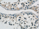 MTIF3 Antibody in Immunohistochemistry (Paraffin) (IHC (P))