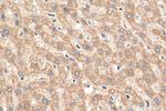 MTIF3 Antibody in Immunohistochemistry (Paraffin) (IHC (P))